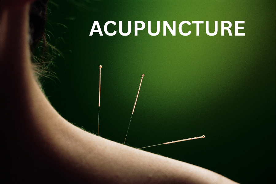 “Acupuncture Services in Denville, NJ - Jersey Wellness Center